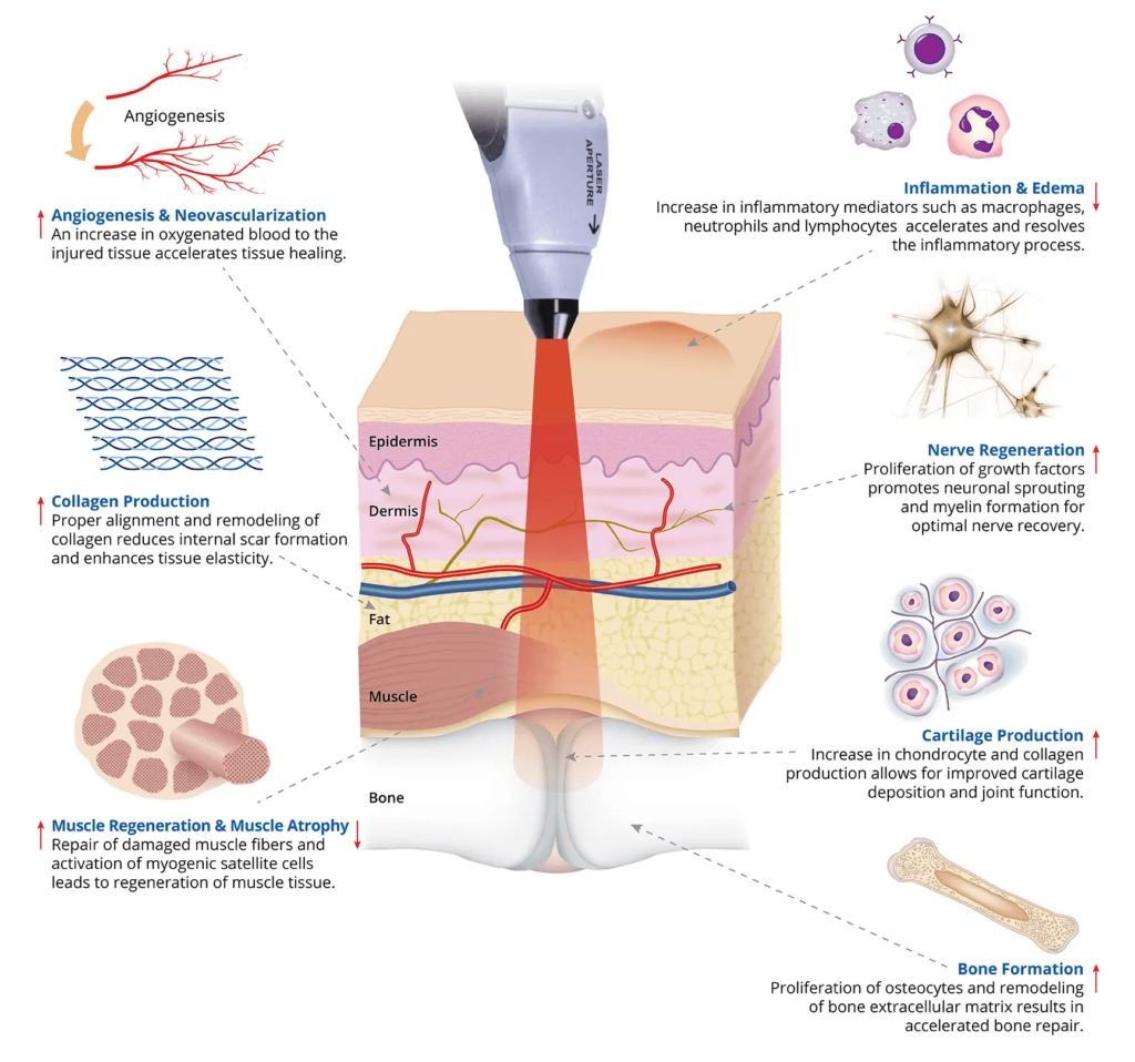 Clinical Effects of Laser Therapy